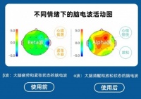 睡眠仪什么牌子好?即眠睡眠仪让你快速进入梦乡!